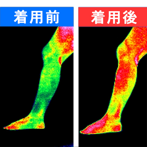 サーモグラフィー