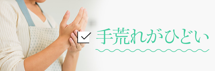 手荒れがひどい