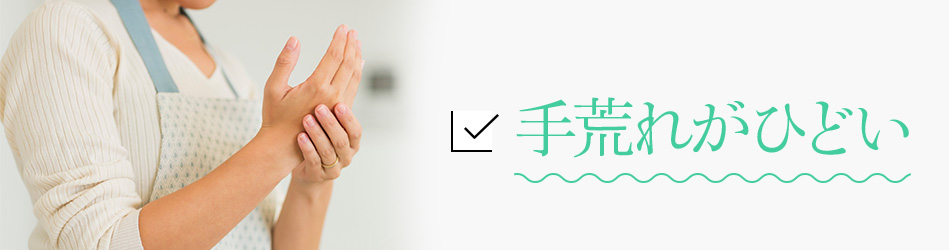 手荒れがひどい
