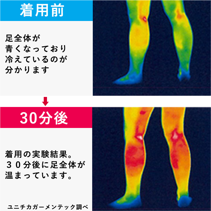 着る岩盤浴 BS FINE ナノレッグウォーマー