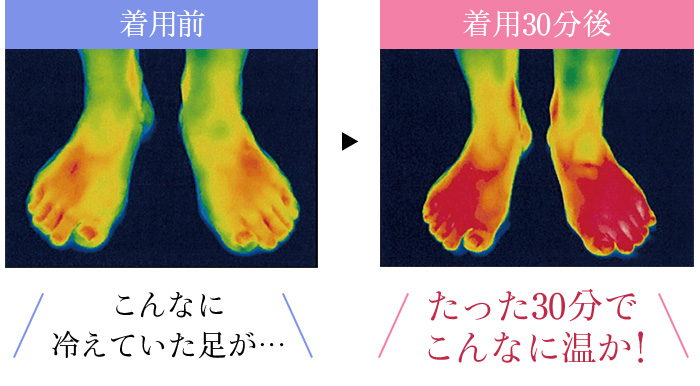着用前 こんなに 冷えていた足が…着用30分後たった30分で こんなに温か!