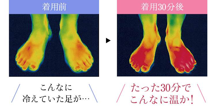 着用前 こんなに 冷えていた足が…着用30分後たった30分で こんなに温か!